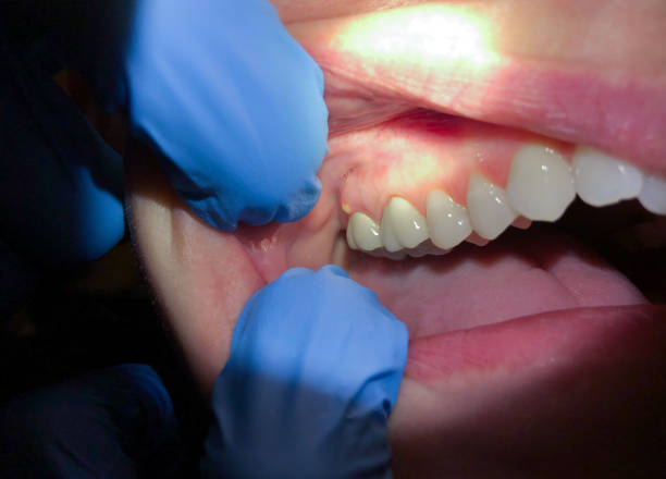 Best Broken Tooth Emergency  in Basin, WY