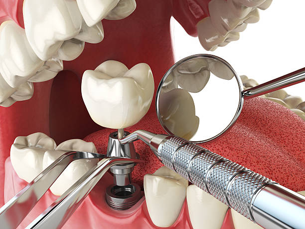 Professional Emergency Dentist in WY